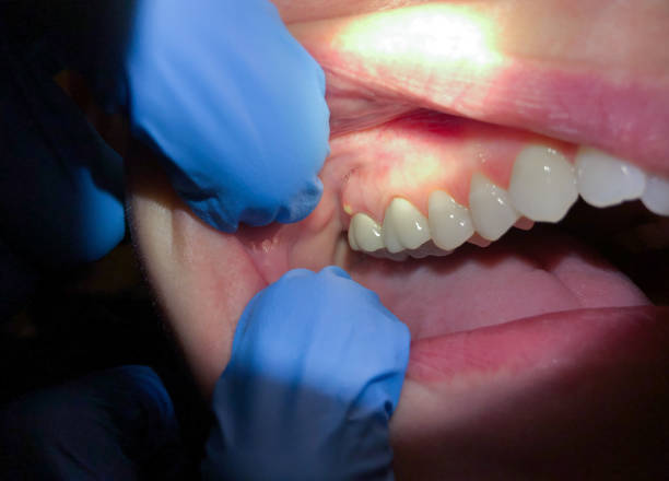 Best Cracked Tooth Emergency Dentist  in Mount Juliet, TN